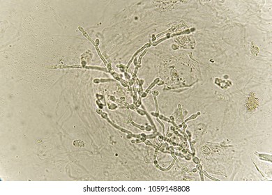 Pseudohyphae Budding Yeast Cells Patient Urine Stock Photo 1059148808 ...