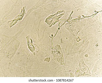 Pseudohyphae Budding Yeast Cells Patient Urine Stock Photo 1087814267 ...