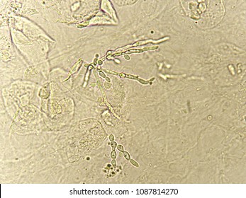 Pseudohyphae Budding Yeast Cells Patient Urine Stock Photo 1087814270 ...