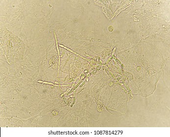 Pseudohyphae Budding Yeast Cells Patient Urine Stock Photo Shutterstock