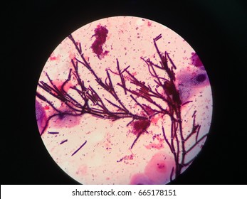 Pseudohyphae From Sputum Culture