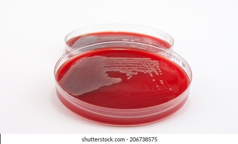 Pseudomonas aeruginosa bacteria on on columbia blood agar