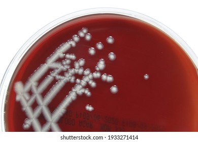 Pseudomonas aeruginosa colonies on Blood agar