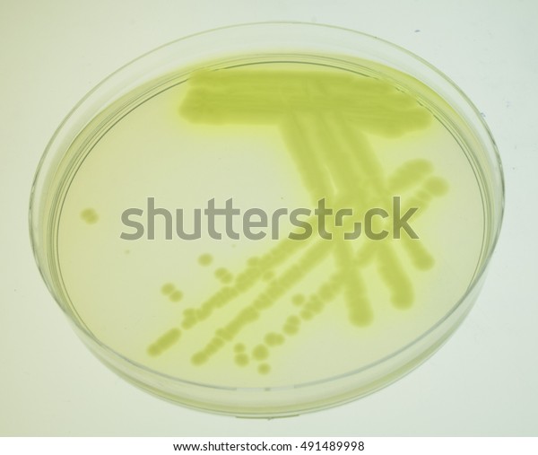 Pseudomonas Aeruginosa Cultivated On King B Stock Photo (Edit Now ...