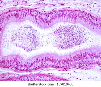 Pseudostratified Columnar Epithelium Epididymis Epithelial Cells Stock ...