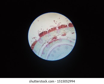 Puccinia Graminis Fungus In Basidiosporous Stage In Microscope