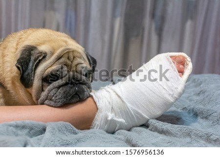 The pug laid his head on the owner's foot. Human foot in a cast. The dog shows pity and compassion.
