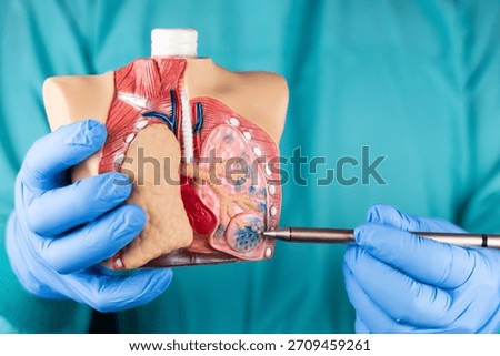 A pulmonologist explains lung diseases using an anatomical model showing the alveoli. Medical concepts related to lung cancer, pulmonary alveolar proteinosis, and respiratory damage.