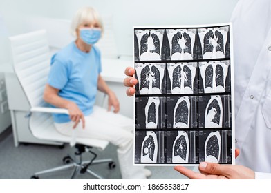 Pulmonologist Showing CT Scan Of Lungs Elderly Patient With Pneumonia. Complication After Coronavirus. Lung Disease, Pulmonary Fibrosis