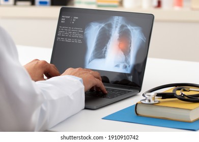 A pulmonologist working with laptop at office. Health care concept.