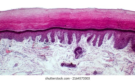 Punch Biopsy Of The Skin. Layers Of Human Skin. Hematoxlyn And Eosin Stain.