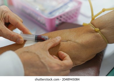 Puncture Of A Vein Through The Skin In Order To Withdraw Blood For Analysis.the Specialist Uses A Syringe To Venipuncture From Patient's Arm. Selective Focus                               