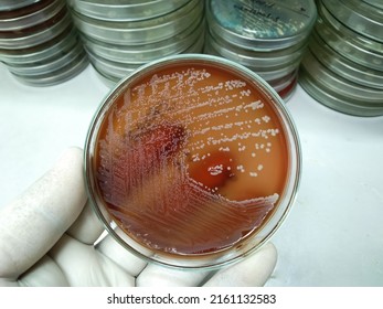 Pure growth of Staphylococcus aureus bacteria on blood agar medium at medical microbiology lab.
