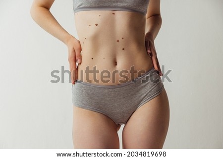 Purity and femininity. Beautiful body with birth marks of young woman isolated on gray studio background. Fit, healthy and slim authentical body. Natural beauty, treatment, healthcare, fitness and