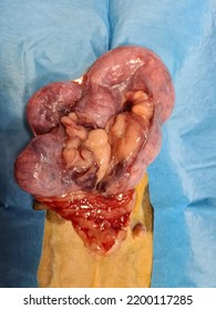 Pyometra During Surgical Operation In Female Dog. Surgical Site.