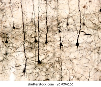 Pyramidal Neurons Of The Cerebral Cortex Impregnated With The Golgi Method.