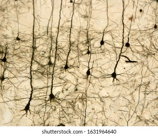 Pyramidal neurons of the cerebral cortex stained with the Golgi silver chromate. From the conic shaped soma, a large apical dendrite and multiple basal dendrites originate.