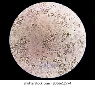 657 White Blood Cell Urine Images, Stock Photos & Vectors | Shutterstock