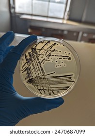 A quadrant streak of the bacterium, Staphylococcus aureus cultured or inoculated on a Baird-Parker agar plate with egg tellurite.