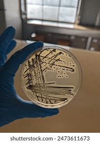 A quadrant streak of the bacterium, Staphylococcus aureus cultured or inoculated on a Baird-Parker agar plate with egg tellurite.