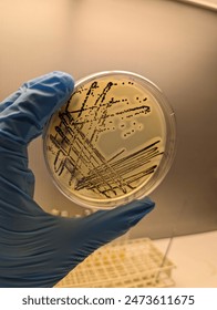 A quadrant streak of the bacterium, Staphylococcus aureus cultured or inoculated on a Baird-Parker agar plate with egg tellurite.