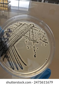 A quadrant streak of the bacterium, Staphylococcus aureus cultured or inoculated on a Baird-Parker agar plate with egg tellurite.