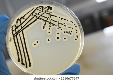 A quadrant streak of the bacterium, Staphylococcus aureus cultured or inoculated on a Baird-Parker agar plate with egg tellurite.