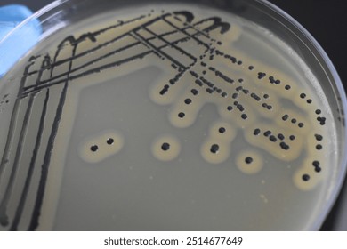A quadrant streak of the bacterium, Staphylococcus aureus cultured or inoculated on a Baird-Parker agar plate with egg tellurite.