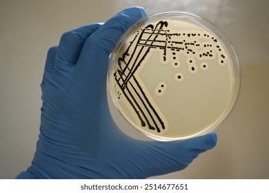 A quadrant streak of the bacterium, Staphylococcus aureus cultured or inoculated on a Baird-Parker agar plate with egg tellurite.