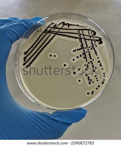 A quadrant streak of the bacterium, Staphylococcus aureus cultured or inoculated on a Baird-Parker agar plate with egg tellurite.