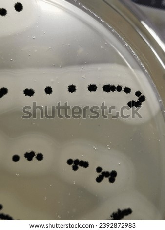 A quadrant streak of the bacterium, Staphylococcus aureus cultured or inoculated on a Baird-Parker agar plate with egg tellurite.