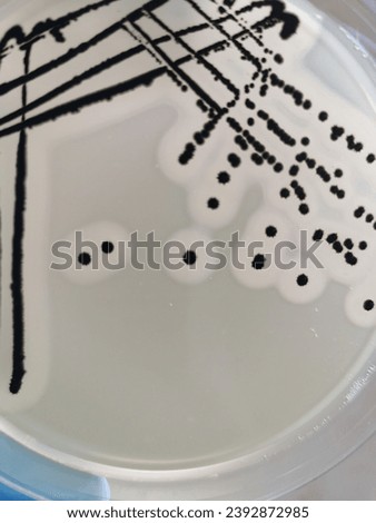 A quadrant streak of the bacterium, Staphylococcus aureus cultured or inoculated on a Baird-Parker agar plate with egg tellurite.