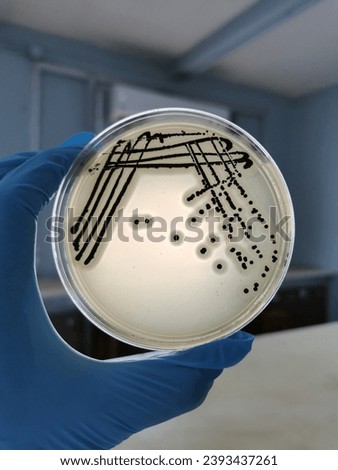 A quadrant streak of the bacterium, Staphylococcus aureus cultured or inoculated on a Baird-Parker agar plate with egg tellurite.