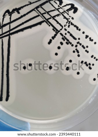 A quadrant streak of the bacterium, Staphylococcus aureus cultured or inoculated on a Baird-Parker agar plate with egg tellurite.