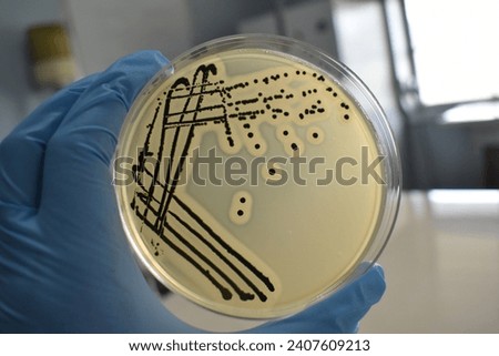 A quadrant streak of the bacterium, Staphylococcus aureus cultured or inoculated on a Baird-Parker agar plate with egg tellurite.