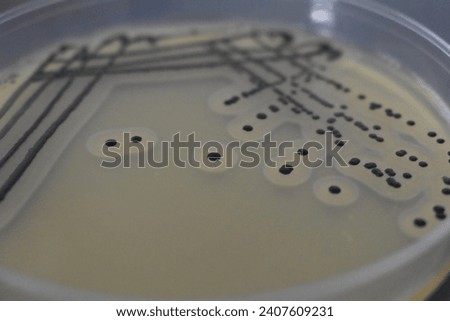 A quadrant streak of the bacterium, Staphylococcus aureus cultured or inoculated on a Baird-Parker agar plate with egg tellurite.