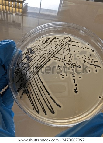 A quadrant streak of the bacterium, Staphylococcus aureus cultured or inoculated on a Baird-Parker agar plate with egg tellurite.