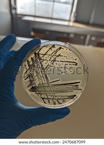 A quadrant streak of the bacterium, Staphylococcus aureus cultured or inoculated on a Baird-Parker agar plate with egg tellurite.