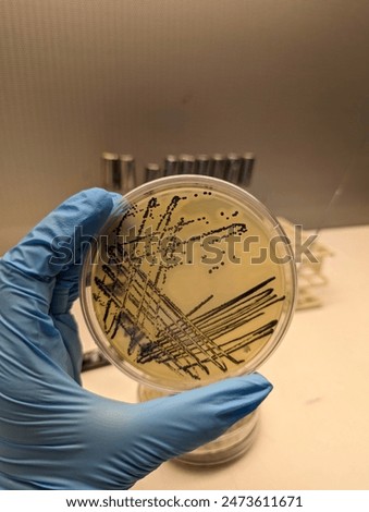 A quadrant streak of the bacterium, Staphylococcus aureus cultured or inoculated on a Baird-Parker agar plate with egg tellurite.