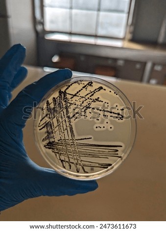 A quadrant streak of the bacterium, Staphylococcus aureus cultured or inoculated on a Baird-Parker agar plate with egg tellurite.