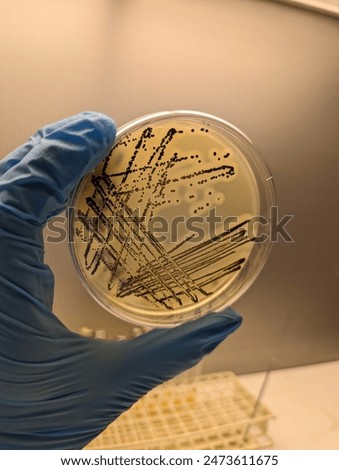A quadrant streak of the bacterium, Staphylococcus aureus cultured or inoculated on a Baird-Parker agar plate with egg tellurite.