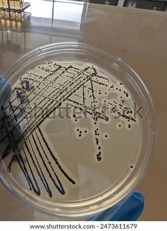 A quadrant streak of the bacterium, Staphylococcus aureus cultured or inoculated on a Baird-Parker agar plate with egg tellurite.
