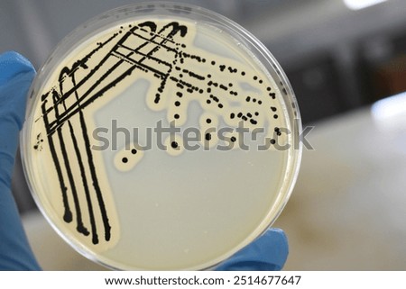 A quadrant streak of the bacterium, Staphylococcus aureus cultured or inoculated on a Baird-Parker agar plate with egg tellurite.