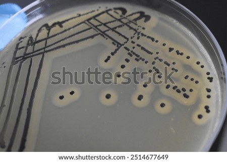 A quadrant streak of the bacterium, Staphylococcus aureus cultured or inoculated on a Baird-Parker agar plate with egg tellurite.