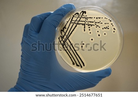A quadrant streak of the bacterium, Staphylococcus aureus cultured or inoculated on a Baird-Parker agar plate with egg tellurite.