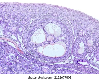 Rabbit Ovary Cross Section Under The Microscope Showing Tunica Albuginea, Primordial Follicles, Primary Follicles, Secondary Follicles, Tertiary Follicle And Cortical Stroma -optical Microscope X100 M