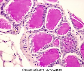 Rabbit Thyroid Gland Pas Method Due Stock Photo 2093021560 | Shutterstock