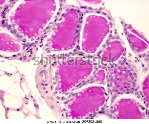 Rabbit Thyroid Gland Pas Method Due Stock Photo 2093021560 | Shutterstock