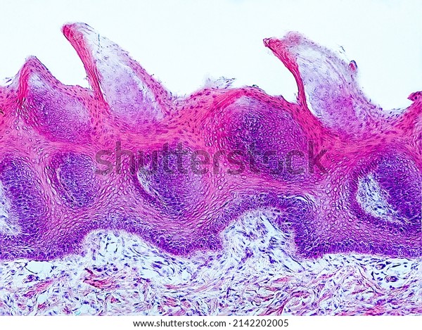 rabbit tongue cross section under the\
microscope showing filiform papillae, taste buds and submucosa -\
optical microscope x400\
magnification