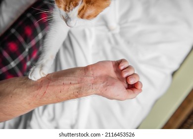 Rabid White-red Cat Furiously Scratched, Bit Through The Mans Hand Until It Bled. Pet Attack. Swollen Scratches From Wild Animal On A Humans Hand. Medical Care, Wound Care. Close Up, Copy Space